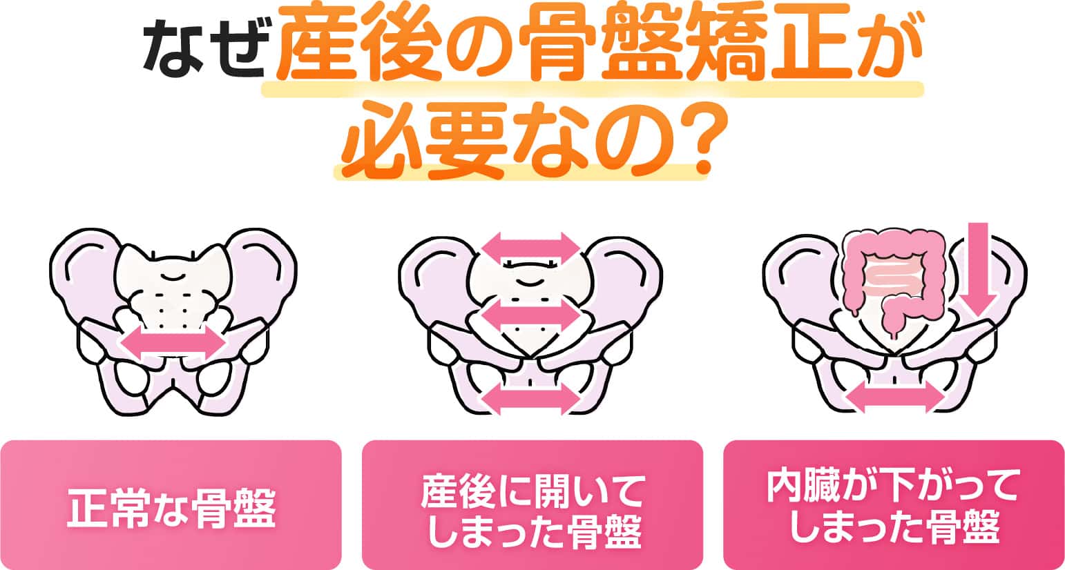 なぜ産後の骨盤矯正が必要なの？