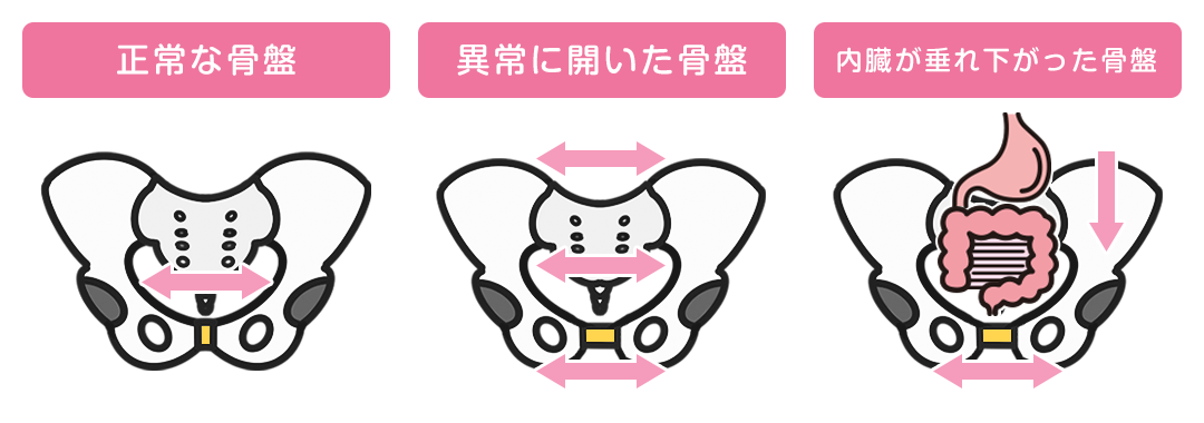産後
